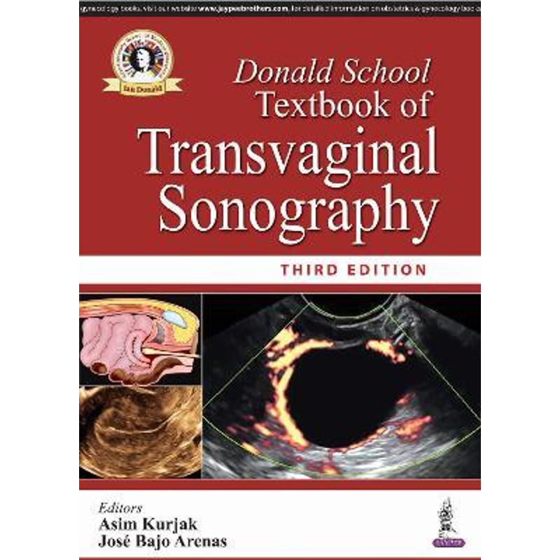 按需印刷不退不换Donald School Textbook of Transvaginal Sonography[9789352701971]