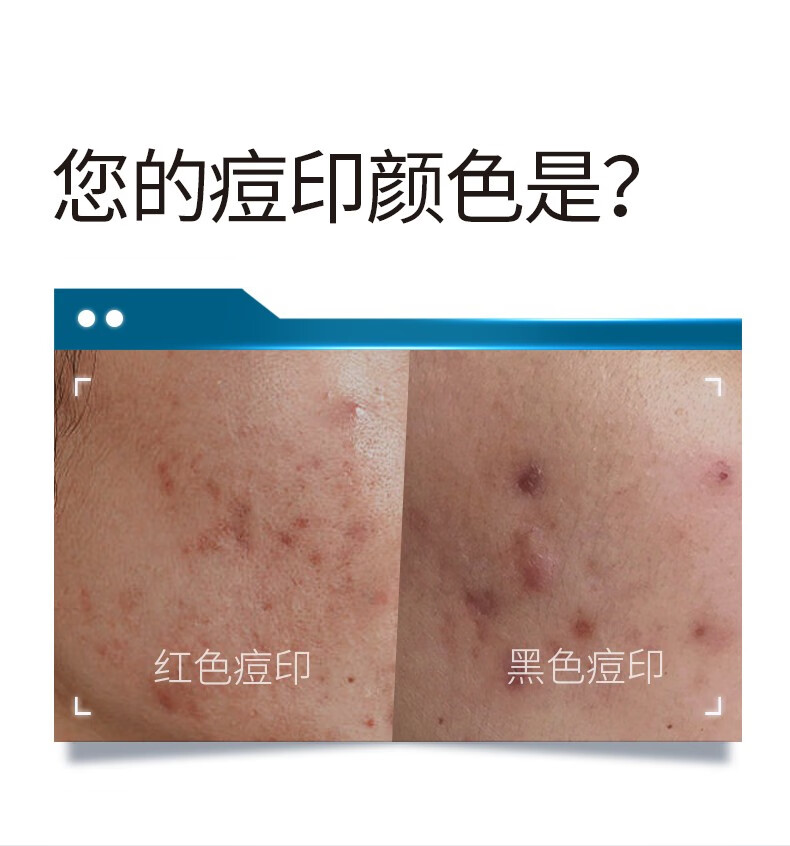肌漾3.0修印精华淡化红黑痘印烟酰胺源头阻黑改善油痘肌 修印精华3.030ml