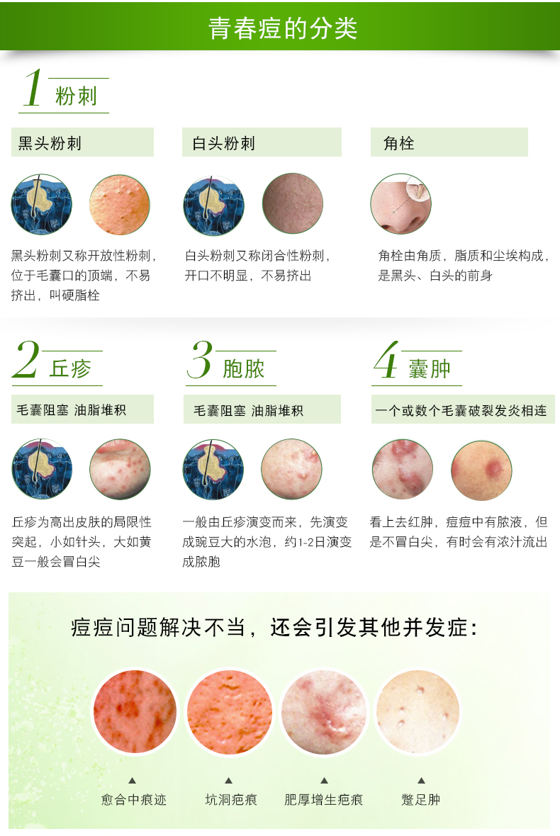 牛尔 茶树痘痘粉刺调理水水杨酸收毛孔控油祛痘 150ml