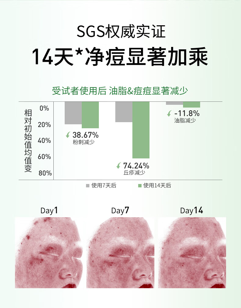 NACO层孔菌控油祛痘精华液次拋混油皮敏肌收缩毛孔肌肤舒缓淡化祛痘印 1盒30支+5支（1.2ML）