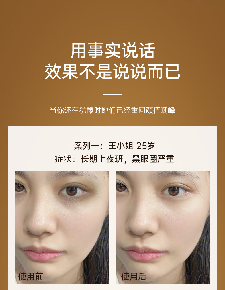EEC小棕瓶精华奢宠眼霜15ml淡化细纹黑眼圈眼袋紧致男女 一瓶