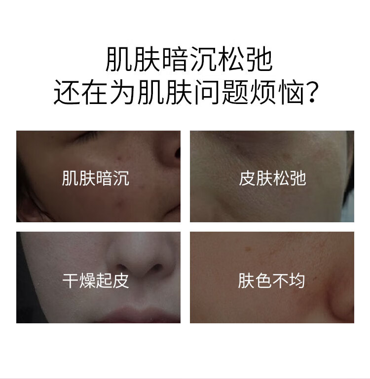 自然妍（CHORNDYE） 软膜粉面膜粉1000g洋甘菊玫瑰茶树美容院专用自制修护提亮肤色补水保湿女 茶树薄荷祛痘软膜粉