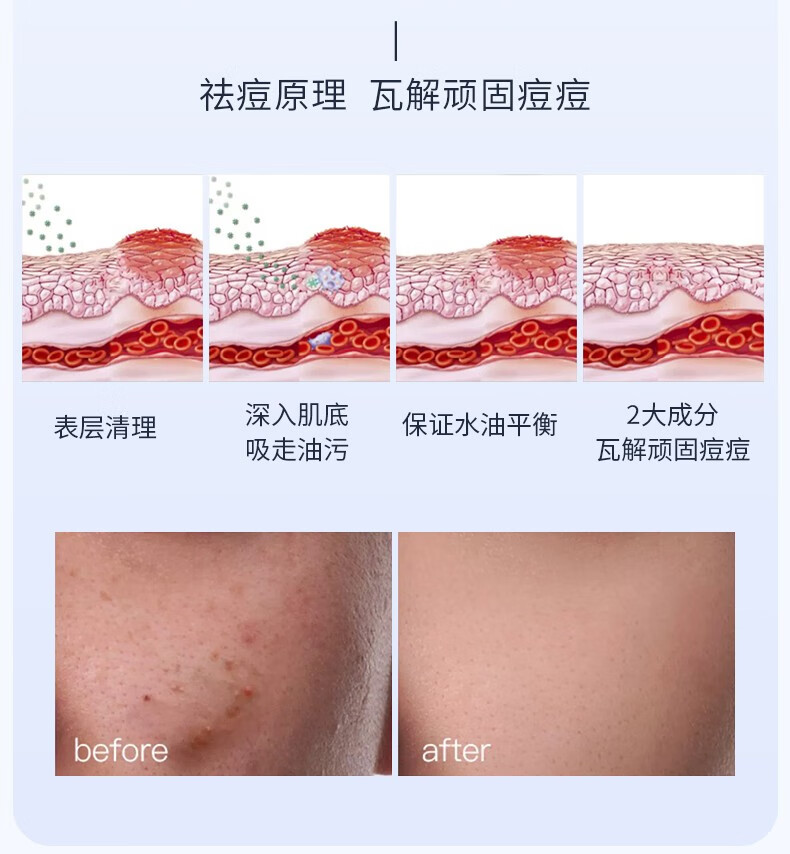 IDX男士控油洗面奶收缩毛孔深层清洁保湿不紧绷抗痘去黑头除螨洁面乳 120g