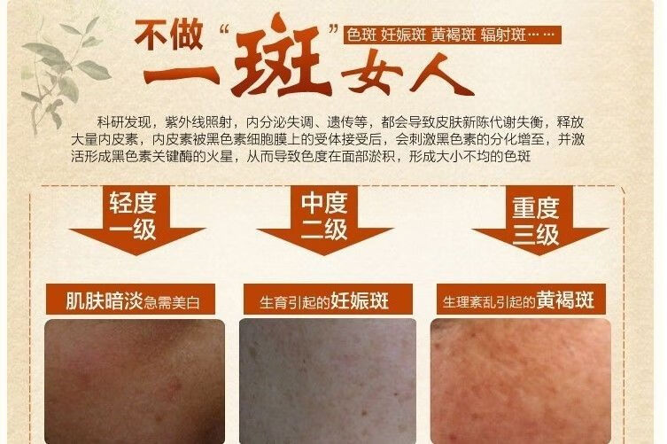 韩泊莉笑影冬虫夏草二合一美白祛斑霜套装淡斑保湿黄褐斑雀斑化妆品 日霜+日霜