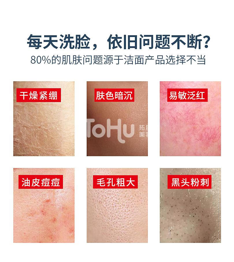 云木颜氨基酸洗面奶深层清洁女男补水保湿清洁毛孔温和控油 氨基酸洗面奶1瓶 100g