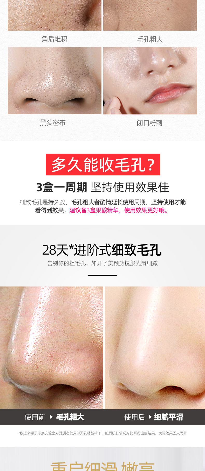 fUT美容院级别果酸精华收缩毛孔精华液祛淡化痘印黑头闭口粉刺男女 【果酸精华液】35ml