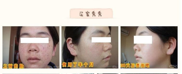 韩泊莉笑影冬虫夏草二合一美白祛斑霜套装淡斑保湿黄褐斑雀斑化妆品 日霜+日霜