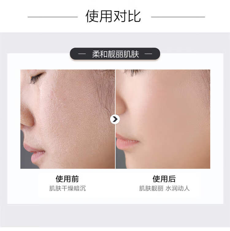 TST 冰肌如玉保湿水乳液洁面霜冻膜精华液活酵母面膜护肤品免洗熬夜 面膜一片有效期10.9日