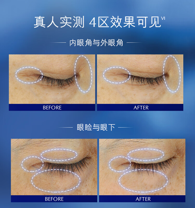 姒桀小棕瓶精华眼霜15ml护肤品淡化细纹黑眼圈生日 小棕瓶眼霜15ml