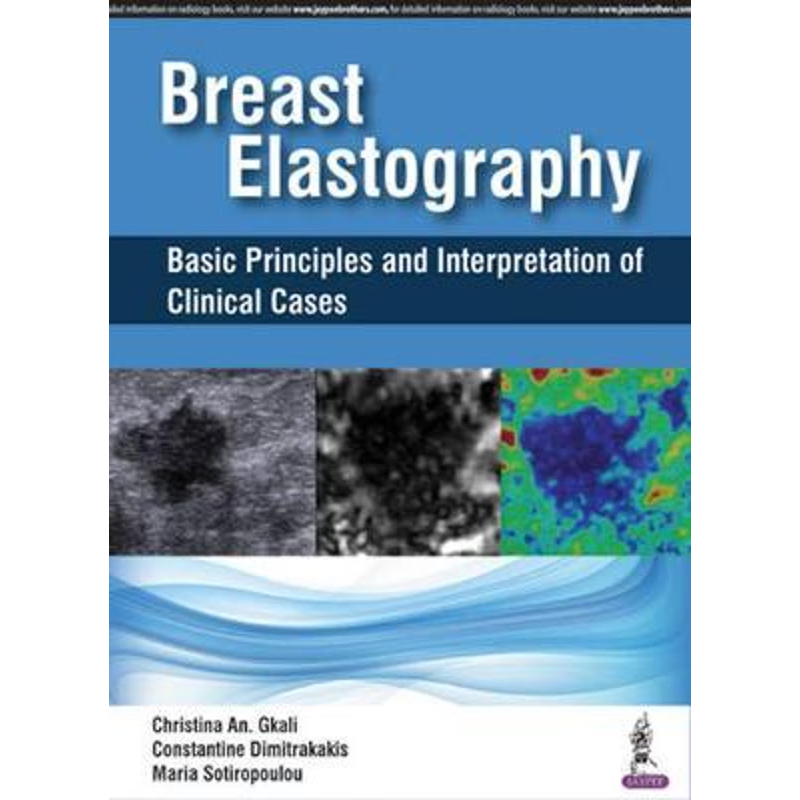 按需印刷Breast Elastography[9789352700578]