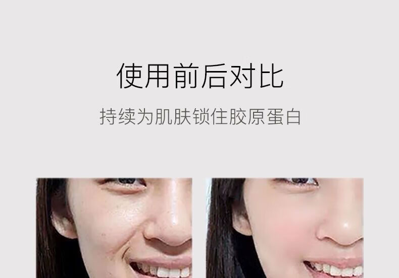 女神之美gimonr姬梦儿胶原蛋白精华液美白祛斑祛痘印舒缓收缩毛孔抗皱 姬梦儿精华1瓶