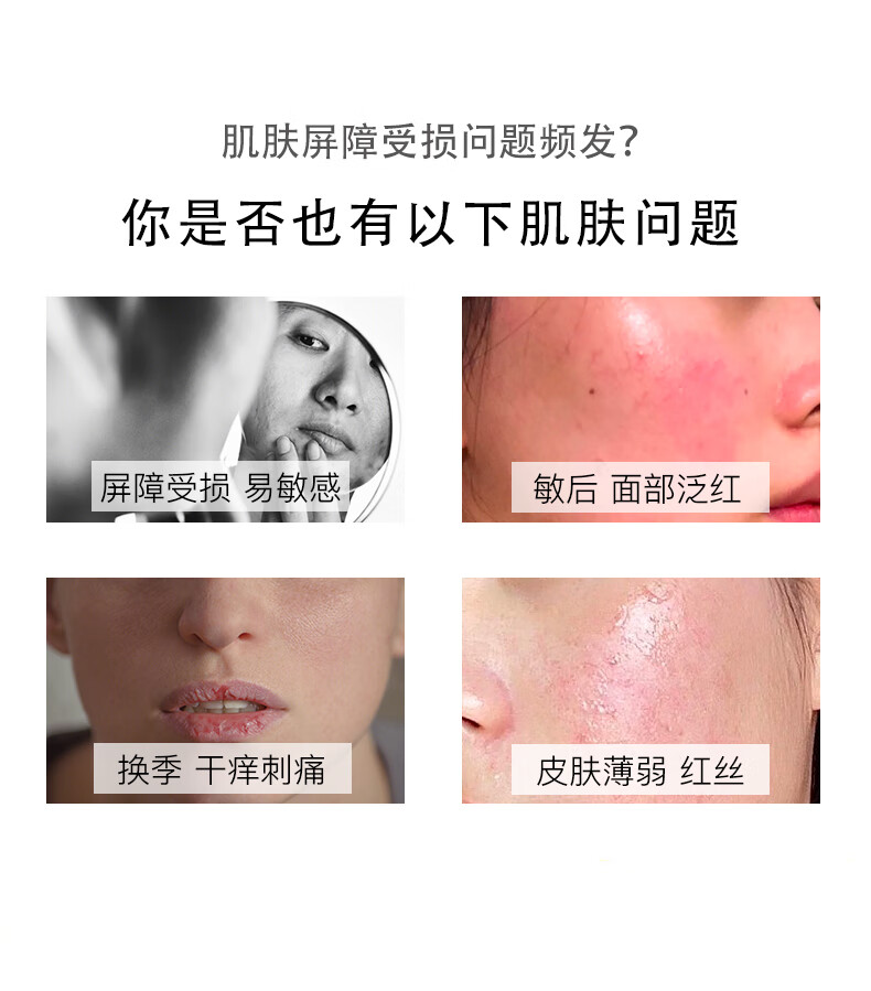 同仁堂北京敏感肌肤修护护肤品套装 草本洋甘菊水乳套装 改善泛红淡化红 四件套