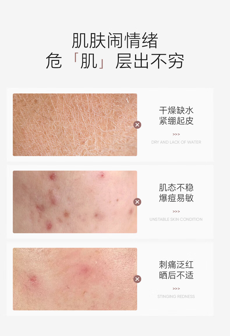 花皙汀（VOCCETIN）花皙汀山茶花沁透舒缓水乳套装敏感肌补水保湿礼盒护肤品送女友B 水120ml 乳120g