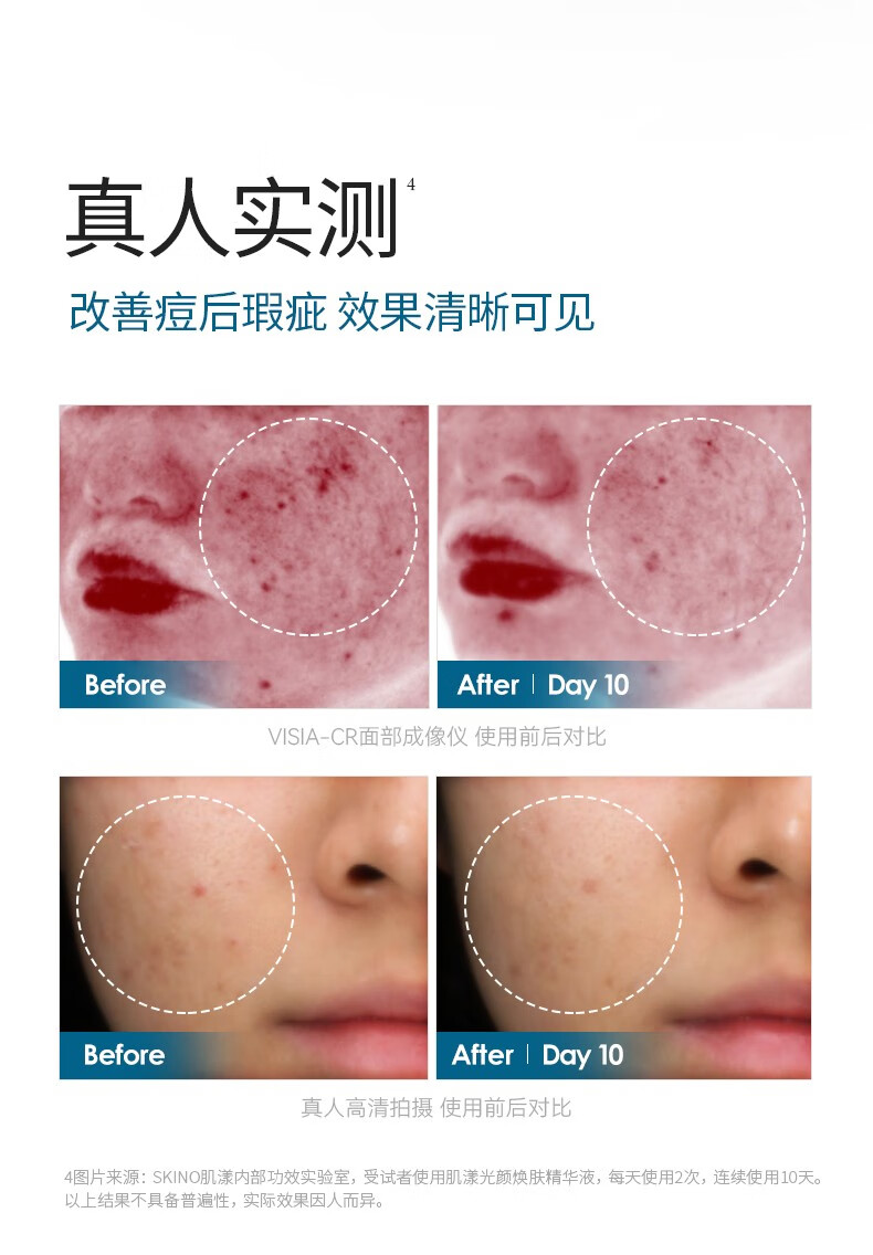 肌漾（SKINO） SKINO肌漾修印精华舒缓修护烟酰胺提亮肤色改善痘肌淡化红黑痘印 30ml