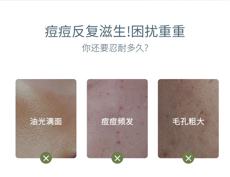 析美  白云山 温和清洁护理皮肤表面 修复淡化痘印 净颜祛痘修护霜30g/盒