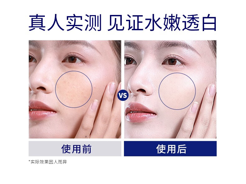 肌肤未来（SKYNFUTURE）集中淡斑精华液男女补水保湿提亮肤色原液修护美白淡斑小白瓶 集中美白祛斑精华液5ml
