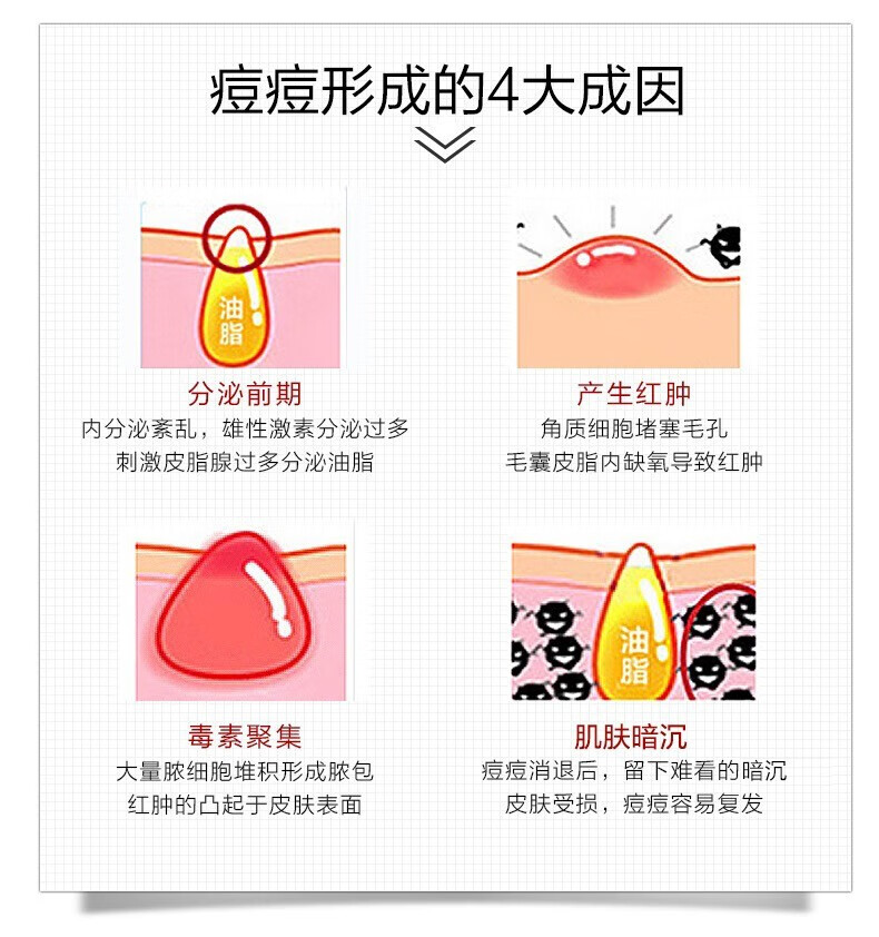 薇诺娜 清痘修护精华液30g 控油保湿 抑制痘痘 舒缓肌肤 30g