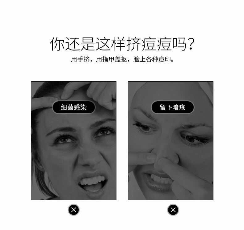 欧亿姿（oeiez） 粉刺针挑挤痘套装工具细胞夹镊子黑头针暗疮针不锈钢美容院 【痘痘/黑头/粉刺】多功能8件套