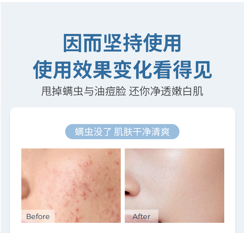 析美 白云山 洁面慕斯洗面奶深层清洁温和补水控油脸部清洁卸妆残留 洁面慕斯100ml