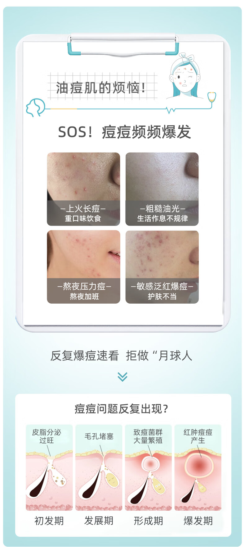 素姬水杨酸控油净痘精华乳改善黑头粉刺清痘精华淡痘控油祛痘痘膏男女