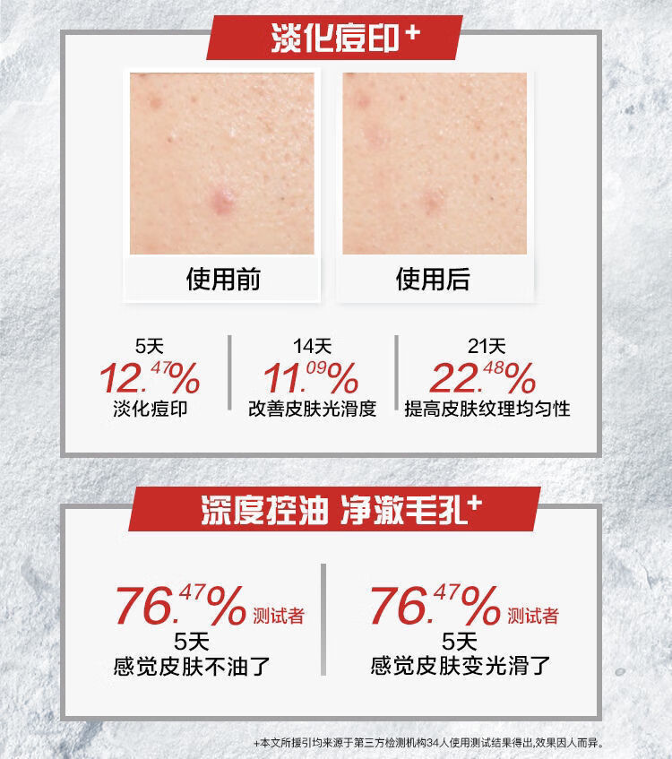 妮维雅男士洗面奶控油保湿水活多效控油冰极洁面泥控油深度清洁学生护肤 控油冰极50g*4瓶