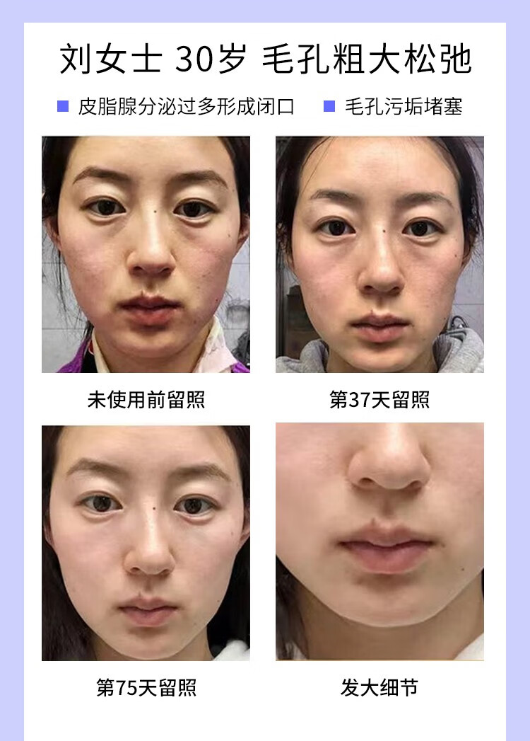 HMOT毛孔收缩精华液收敛毛孔粗大修复细致抗皱精华原液补水保湿男女士 1瓶体验装【推荐周期使用】