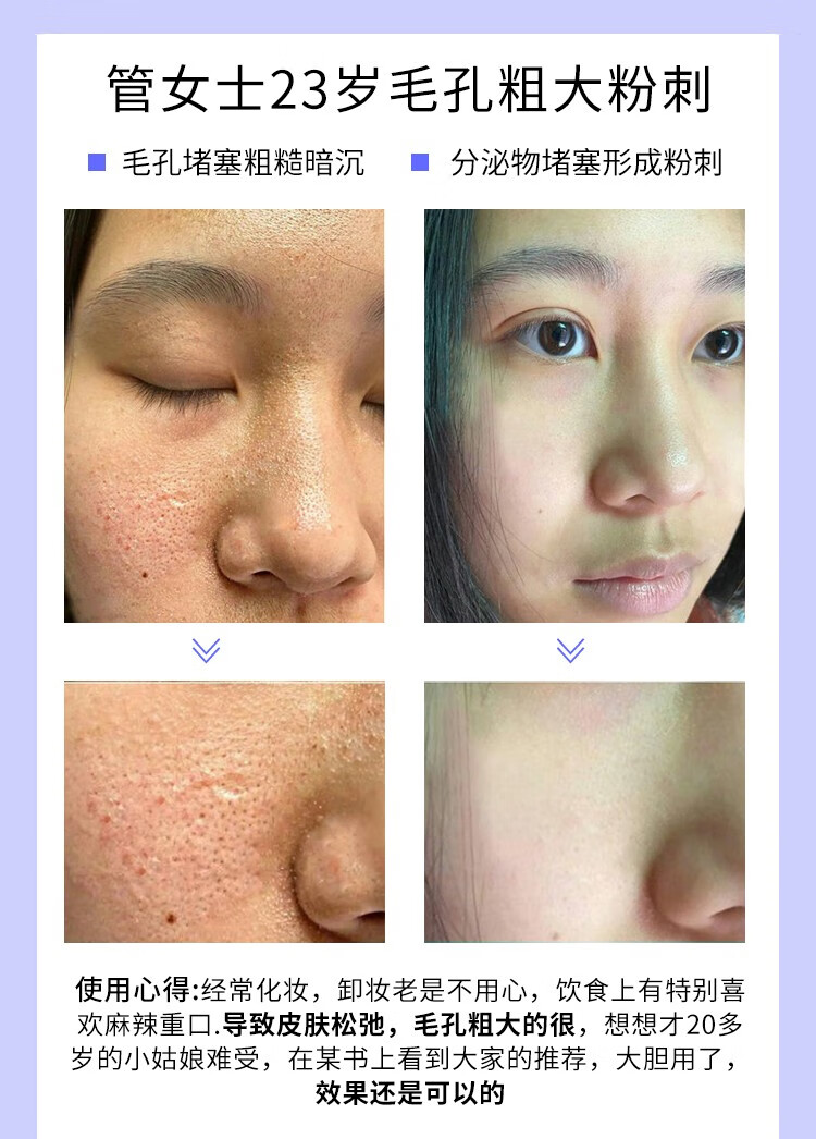 HMOT毛孔收缩精华液收敛毛孔粗大修复细致抗皱精华原液补水保湿男女士 1瓶体验装【推荐周期使用】