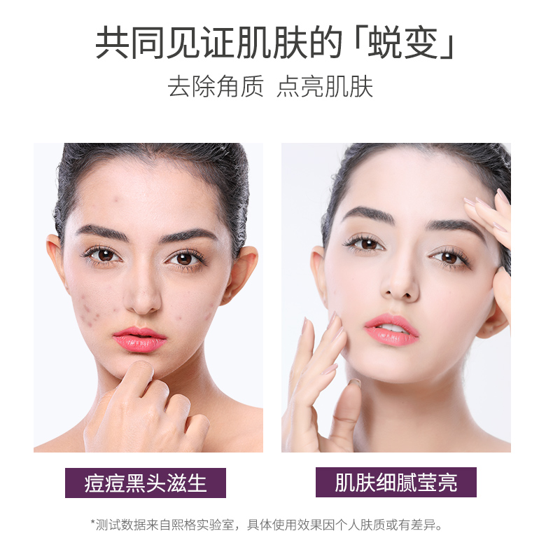 SIGIOR/熙格去角质面部女深层清洁收缩毛孔脸部去死皮黑头男士 80ml