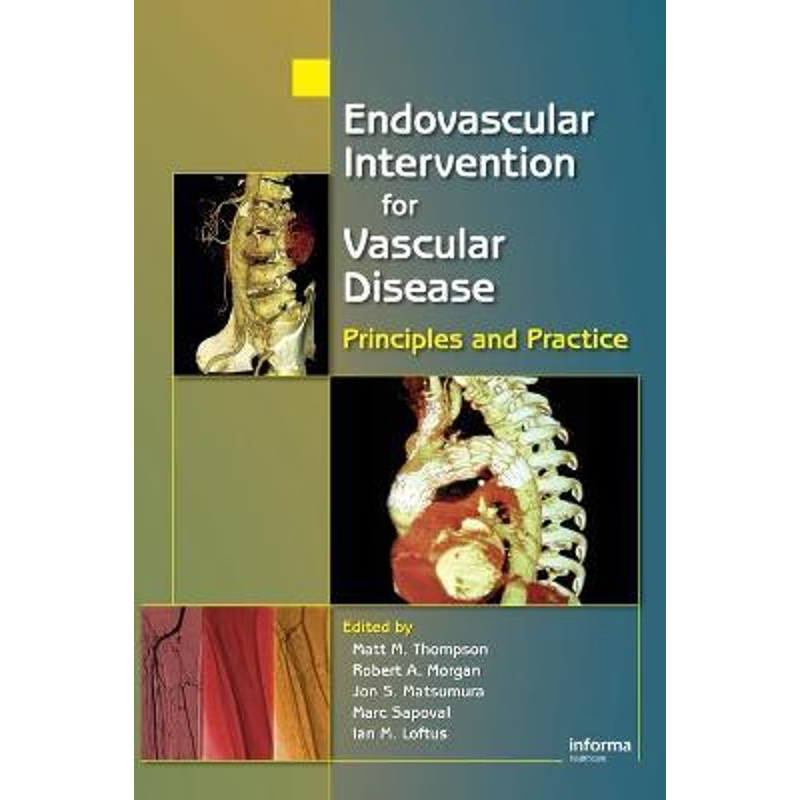 预订Endovascular Intervention for Vascular Disease:Principles and Practice
