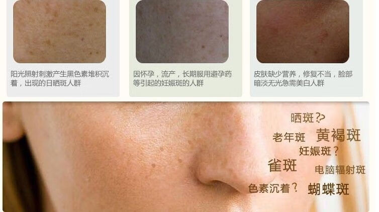 韩泊莉笑影冬虫夏草二合一美白祛斑霜套装淡斑保湿黄褐斑雀斑化妆品 日霜+日霜