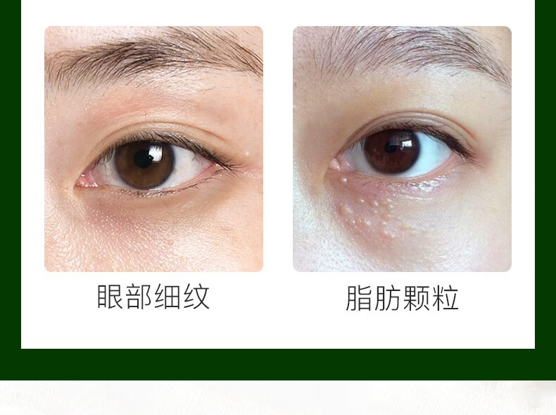 碧雅漫海藻眼膜贴(60贴) 淡化黑眼圏眼黛熬夜眼贴男女通用 海藻柔嫩眼膜60贴X1盒
