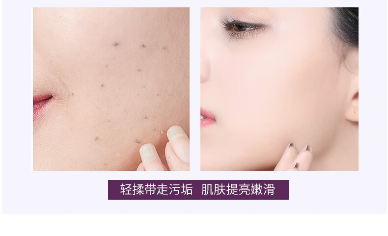 SIGIOR/熙格去角质面部女深层清洁收缩毛孔脸部去死皮黑头男士 80ml
