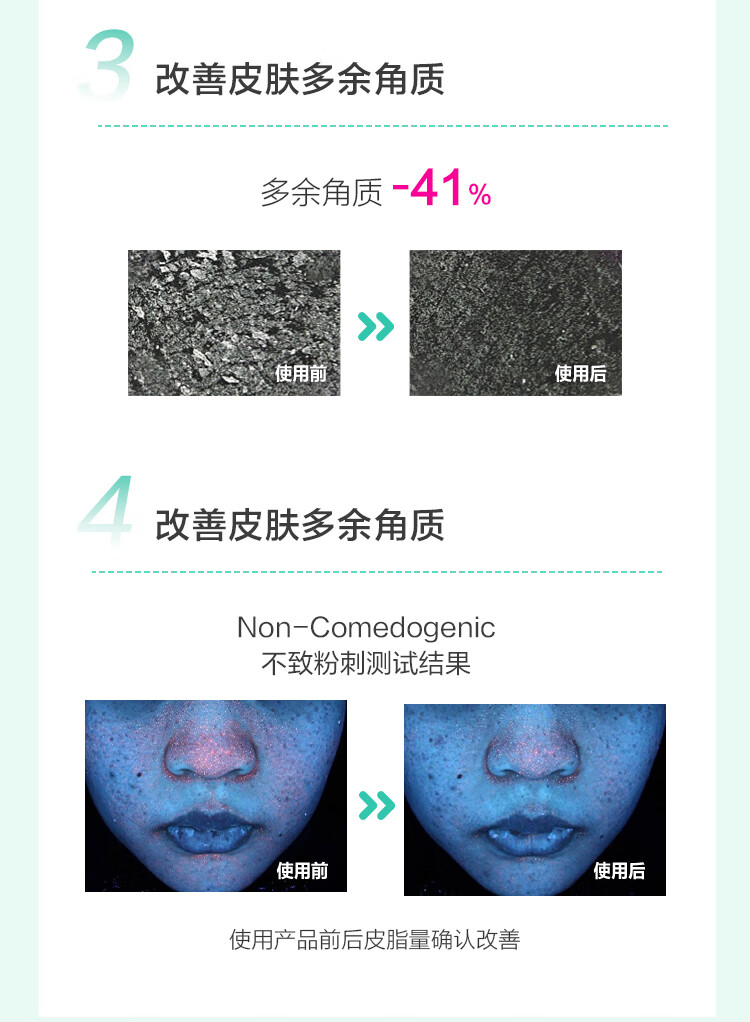 芭兰歌林（BRING GREEN）茶树面霜清爽控油保湿修护舒缓水凝霜秋冬滋润面部护肤品换季 茶树修护舒缓面霜100ml