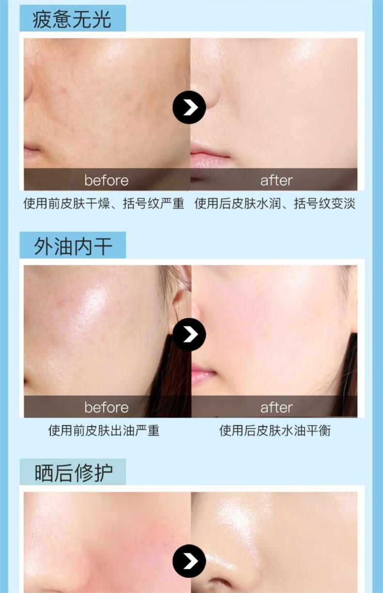 瑞倪维儿（Rinawale）透明质酸凝胶60g康婷面部护肤品芦荟胶修护补水保湿滋养舒缓肌肤 1支装