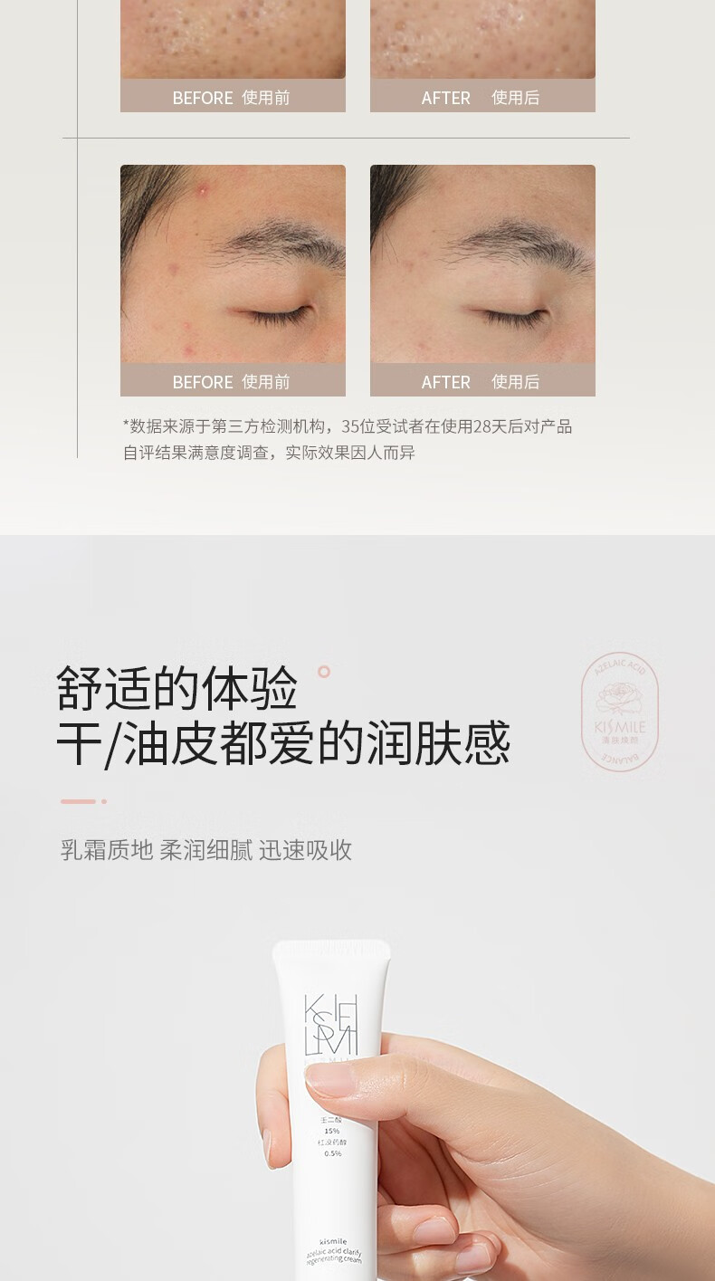 kismile壬二酸15%凝胶毛孔霜痘清改善痘痘去黑头面霜 10g 【薄涂、建立耐受】