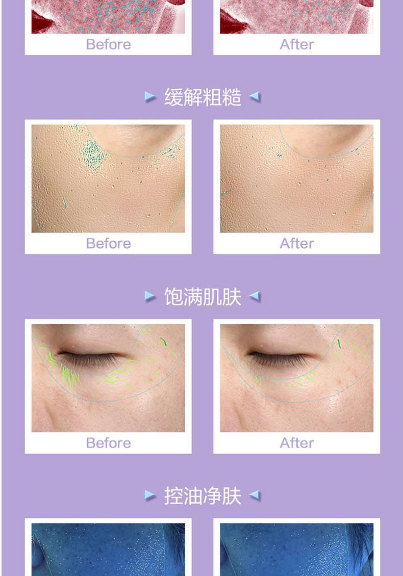 米蓓尔（MedRepair） MedRepair华熙米蓓尔蓝绷带面膜补水保湿修护舒缓敏感肌涂抹泥膜 1盒装110g