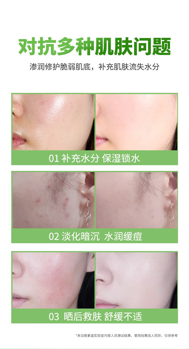碧素堂库拉索芦荟胶300g补水保湿熬夜晒后护肤面霜大瓶装男女士学生可用 芦荟胶大容量300g