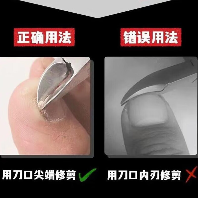 美道 指甲刀鹰嘴钳单个装尖嘴鹰嘴钳剪刀修脚甲工具套装 黑色 甲沟钳（不锈钢+PP手柄）
