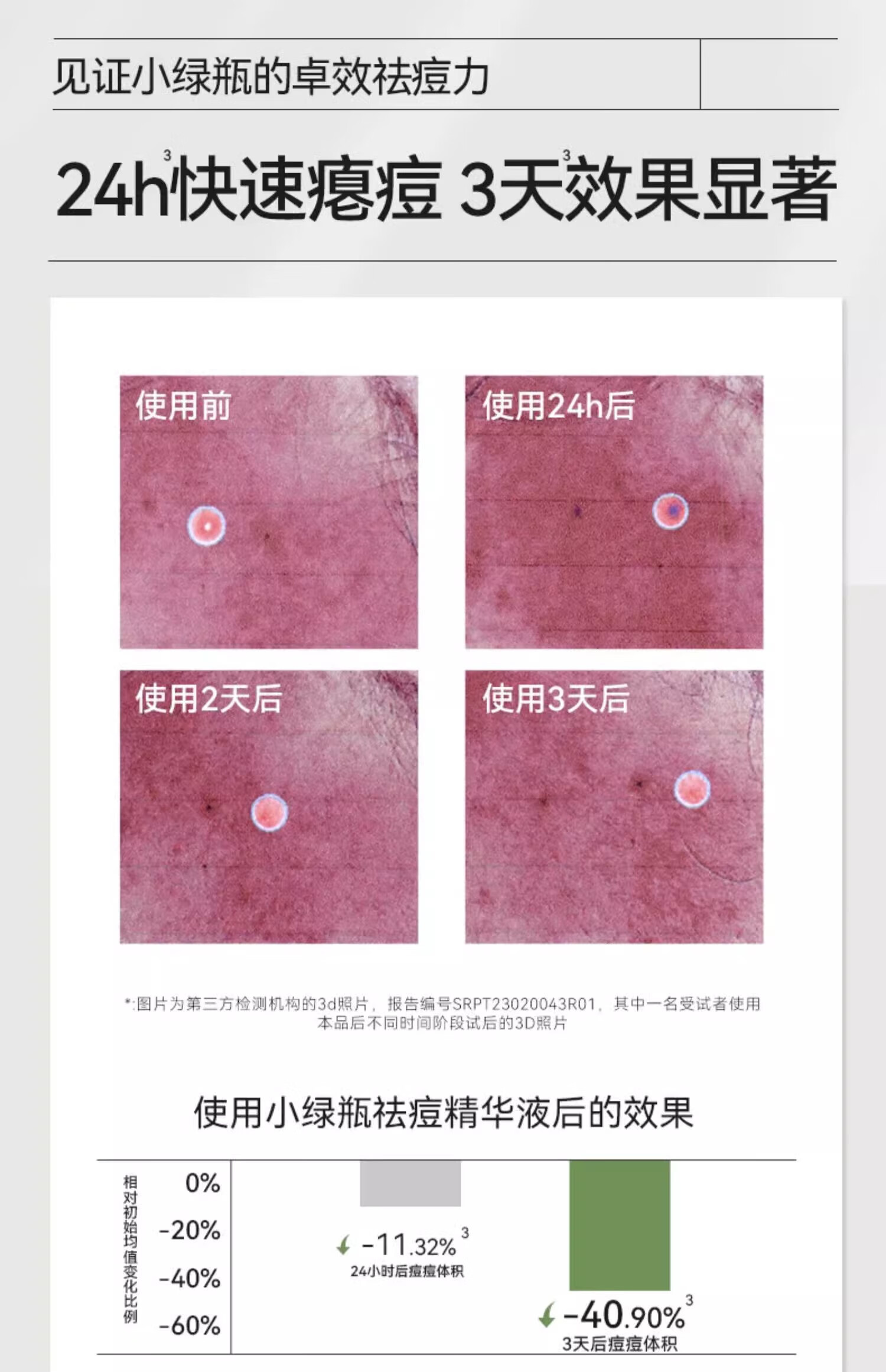 丽可植 BEAUTYCOZY丽可植小绿瓶祛痘精华液淡化痘印祛痘淡印精华祛闭口粉刺痘旗舰 雪柔雅升级款*1【体验装】介意慎拍