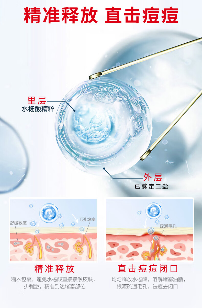 RYDEEN壬二酸祛痘膏凝胶淡化痘印痘坑青春痘成人痘粉刺黑头抗痘 1支