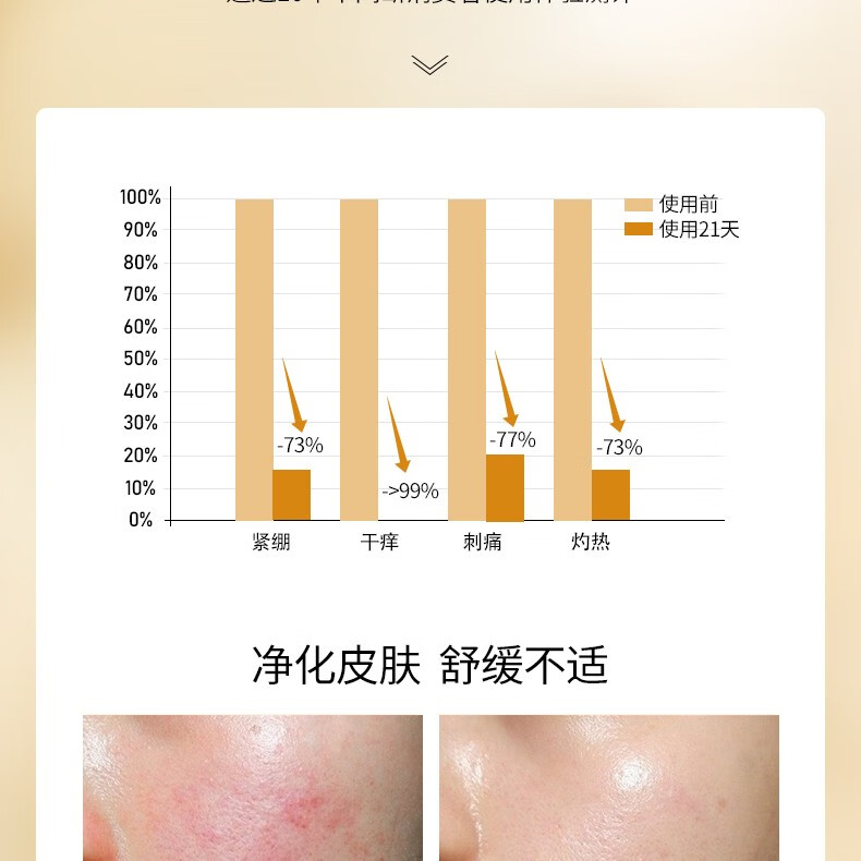 TREECHADA泰国TR进口椰子卸妆油眼唇脸三合一深层清洁毛孔温和敏感肌 1瓶：椰子卸妆油
