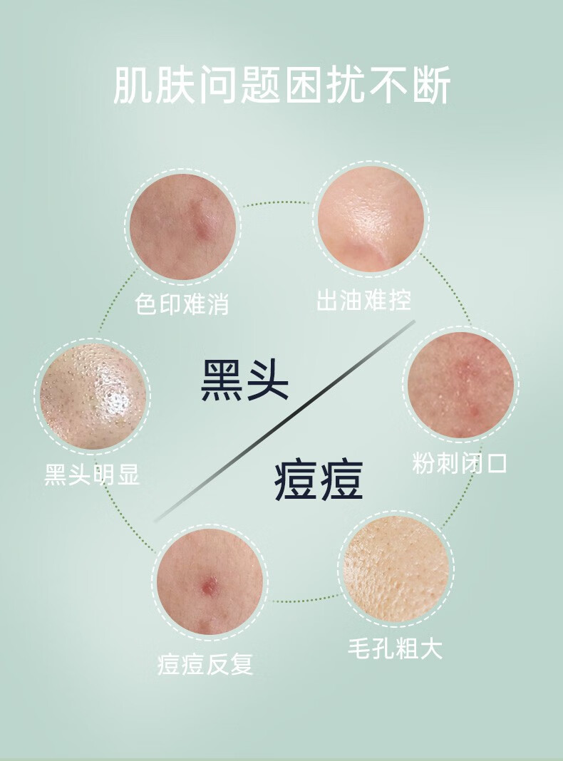 珂语（KEYU） 清痘调理凝胶祛痘清痘净粉刺修护痘肌控油收敛毛孔改善肌肤 1盒(6支装)