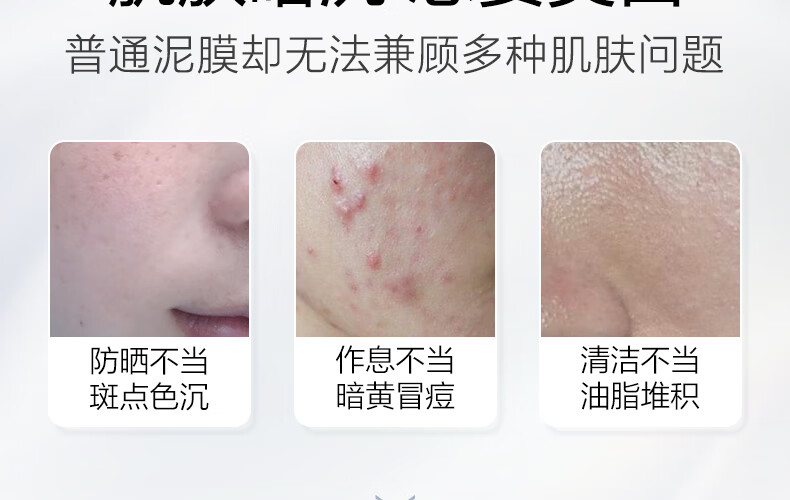 欧诗漫（OSM）珍珠美白淡化斑发光面膜泥50g涂抹精华膏清洁美白保湿护肤品女 【美白淡斑】50g+面膜*2盒