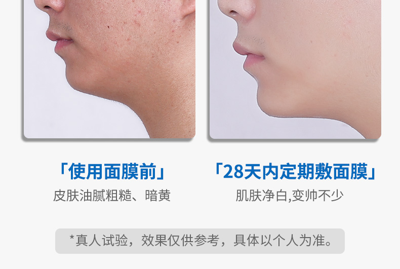 赫恩（H&E） 【套装可选】男士美白面膜烟酰胺补水保湿控油面膜 美白面膜6片/盒