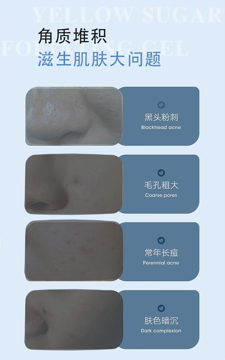 琪瑟面部去角质去死皮膏全身体可用温和嫩肤保湿清洁脸部男士女士凝胶 150ml*2支装）