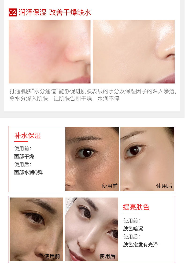 媛后 维生素E乳VE身体乳液面霜秋冬季保湿补水滋养敏肌肤护肤乳护手霜 经典维生素E乳*3瓶