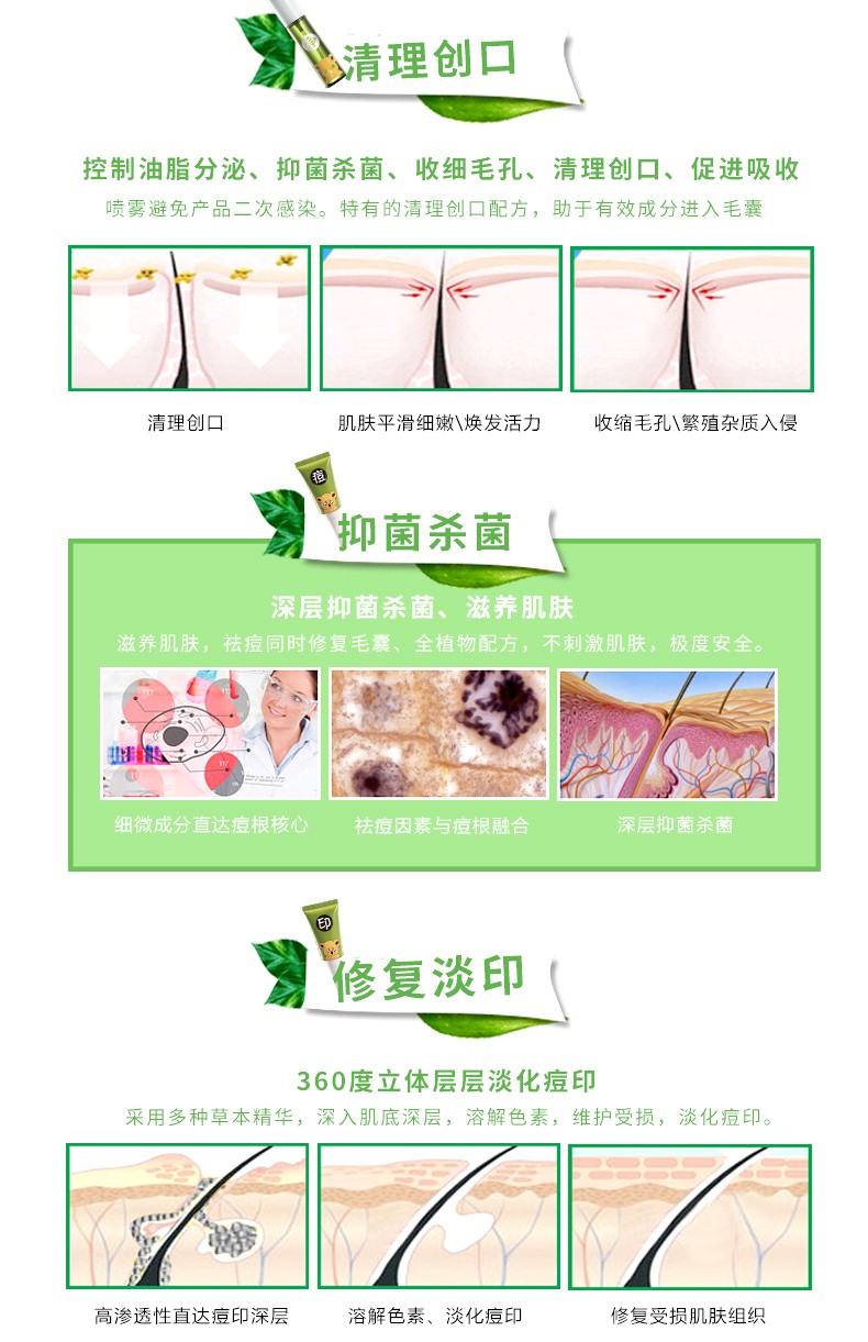 哲科（Z.Care） 哲科茶树祛痘霜茶树淡印霜茶树祛痘净肌喷雾套装青春痘学生男女