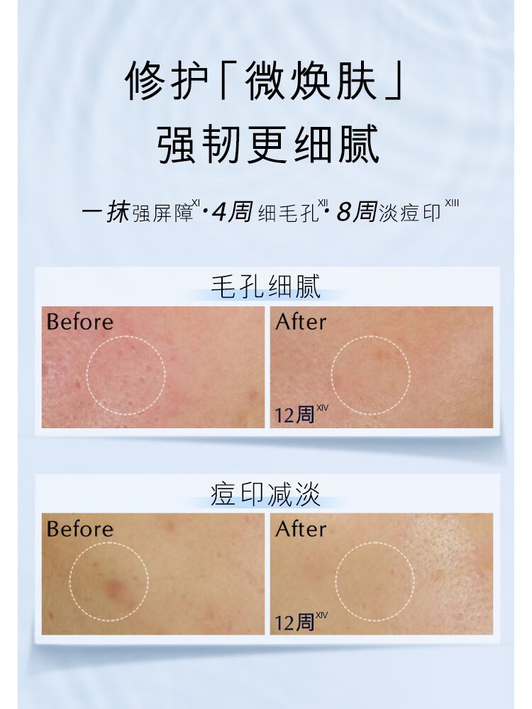 雅诗兰黛（Estee Lauder） 微精华露 保湿补水护肤品 生日礼物 经典版 买200ml享400ml礼盒