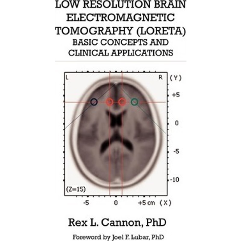 按需印刷Low Resolution Brain Electromagnetic Tomography (LORETA)[9780982749814]