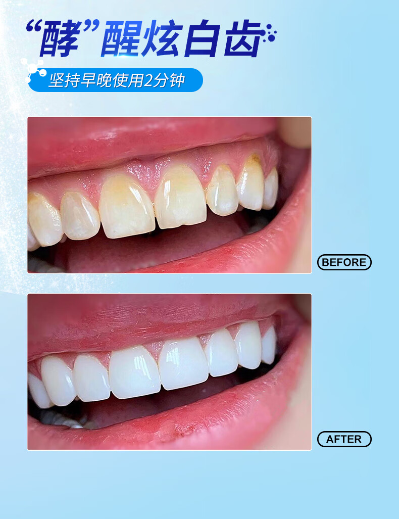 炫迈爽酵素牙膏牙齿洁白清新口气减少牙渍垢美护牙龈口臭亮白去大容量装 酵素牙膏180gx2支.